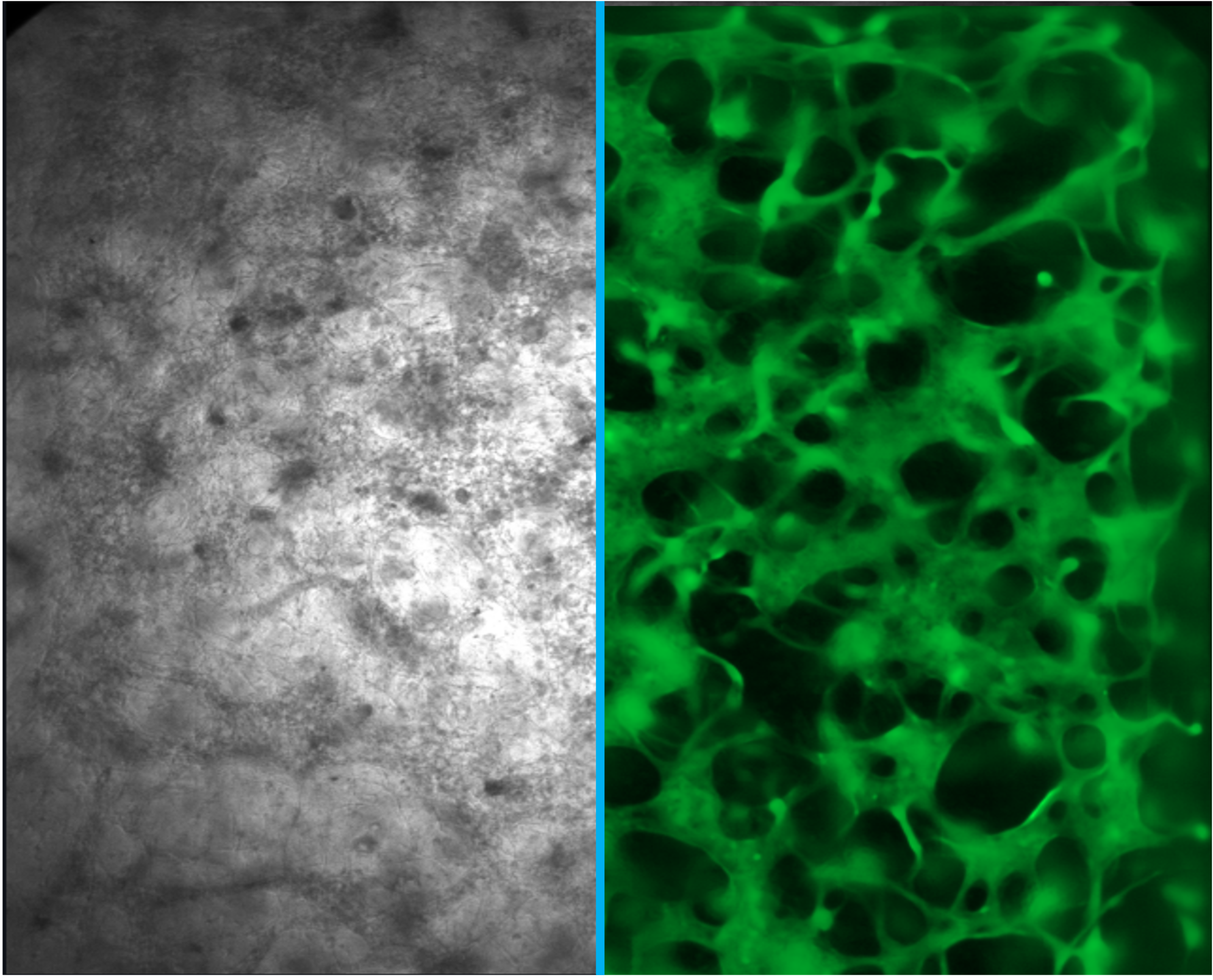 Paired brightfield and fluorescence microscopy of human tissue feeding the models