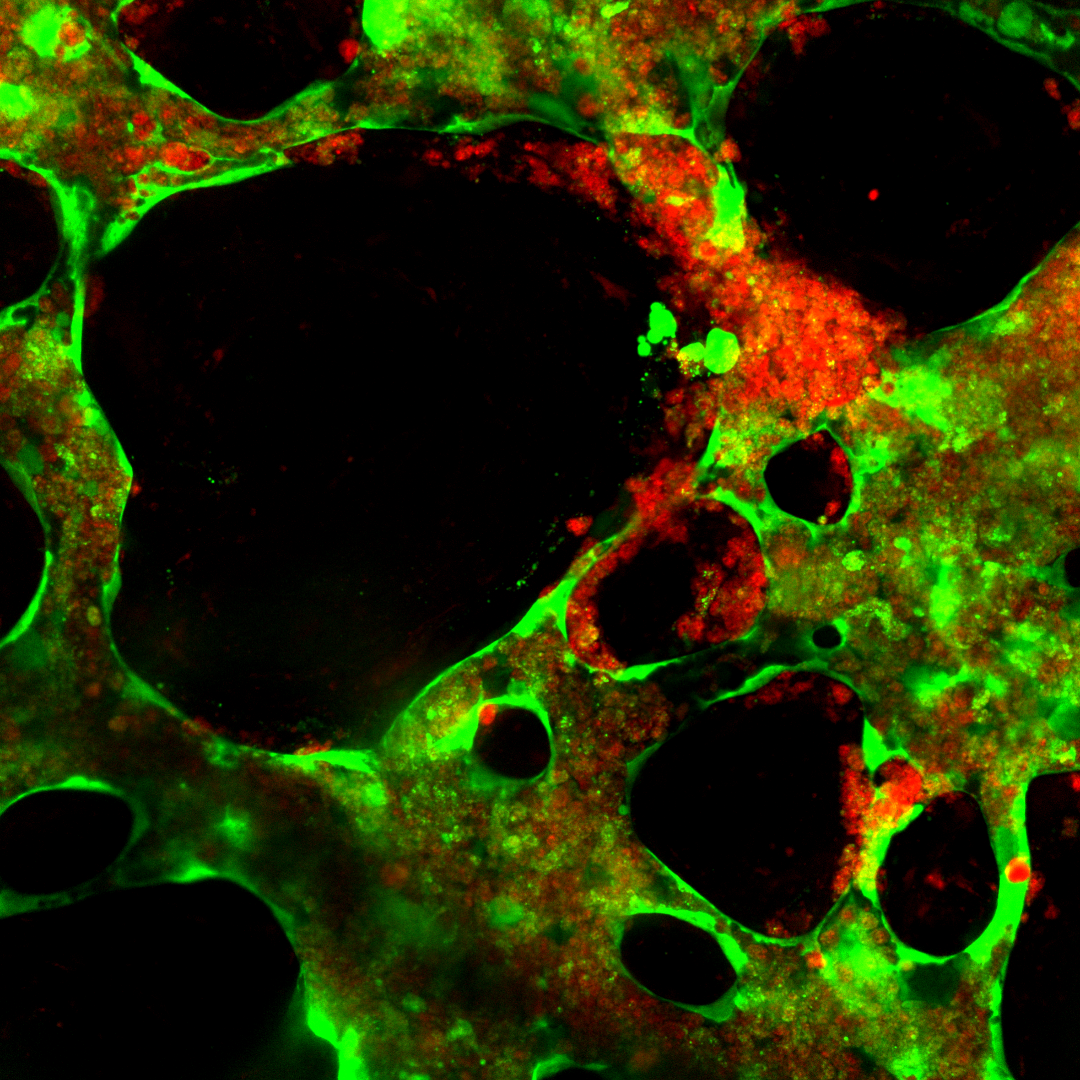 Confocal microscopy of lab-grown human tissue